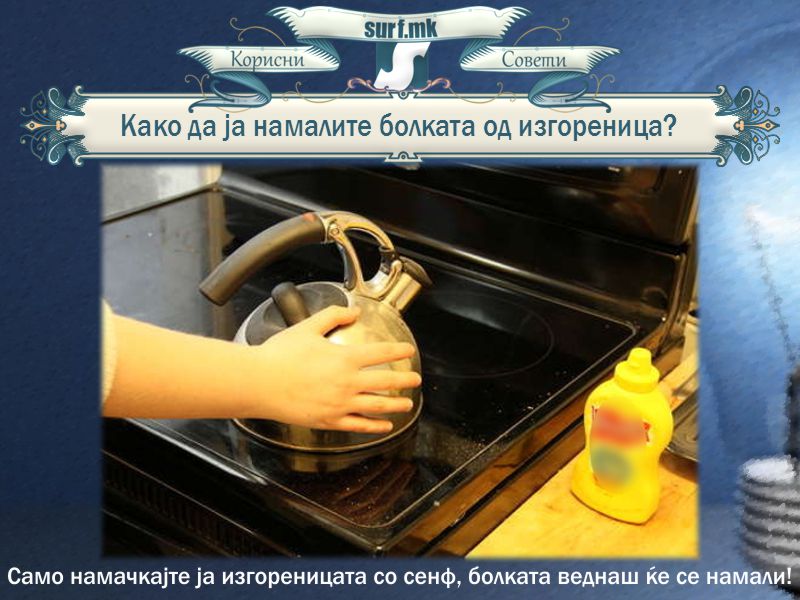 Како да ја намалите болката од изгореница?